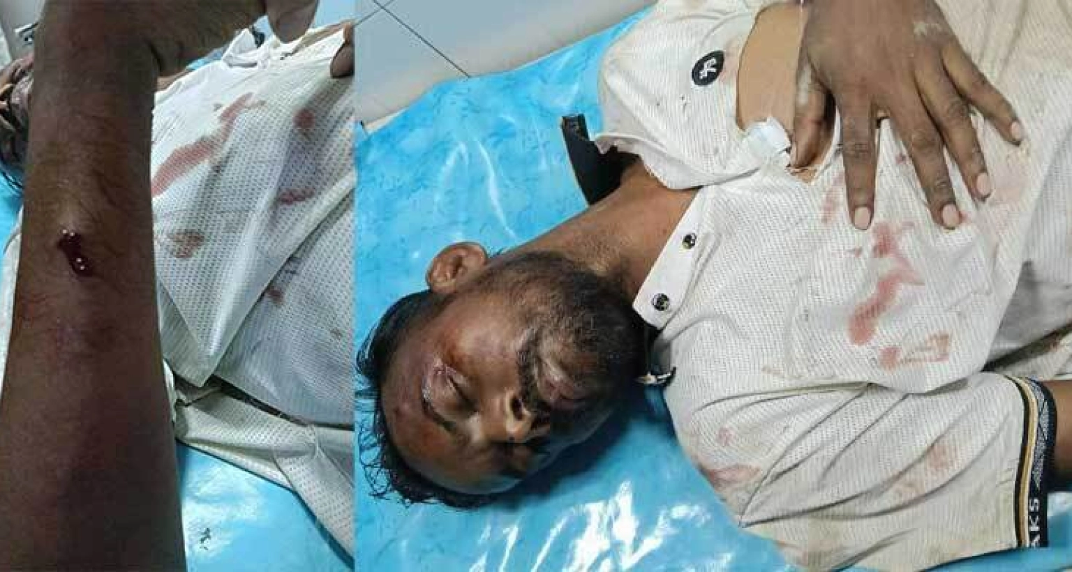 হিরো আলমের অবস্থা ‘আশঙ্কাজনক’, বদলাতে হলো হাসপাতাল
